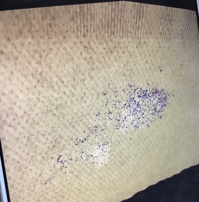 Hier z.B. kann man das Mikroplastik sehen. Moikroplastik ist schädlich für unsere Haut also greifen sie am besten nicht nach Seife mit Mitkroplastik drinne